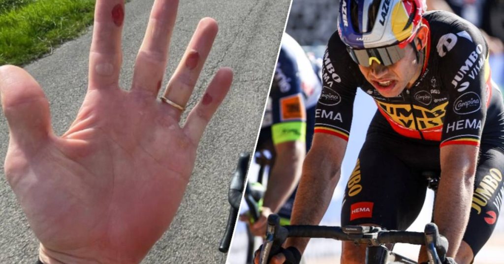 Van Aert shows damage to his hand the day after Rubiks and confirms participation in Liege-Bastogon-Liege |  Instagram HLN