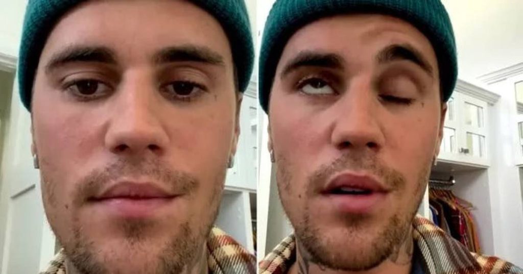 Justin Bieber recovering from facial paralysis: 'It was a scary situation' |  Famous People