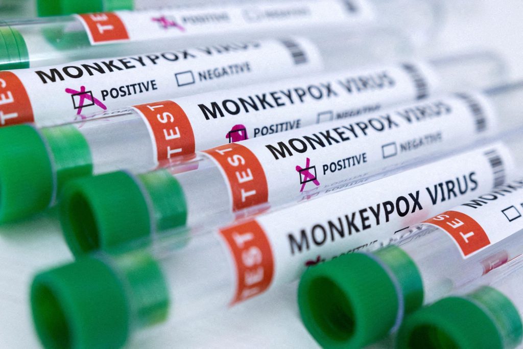 More than 15,000 cases of monkeypox in Europe and two deaths